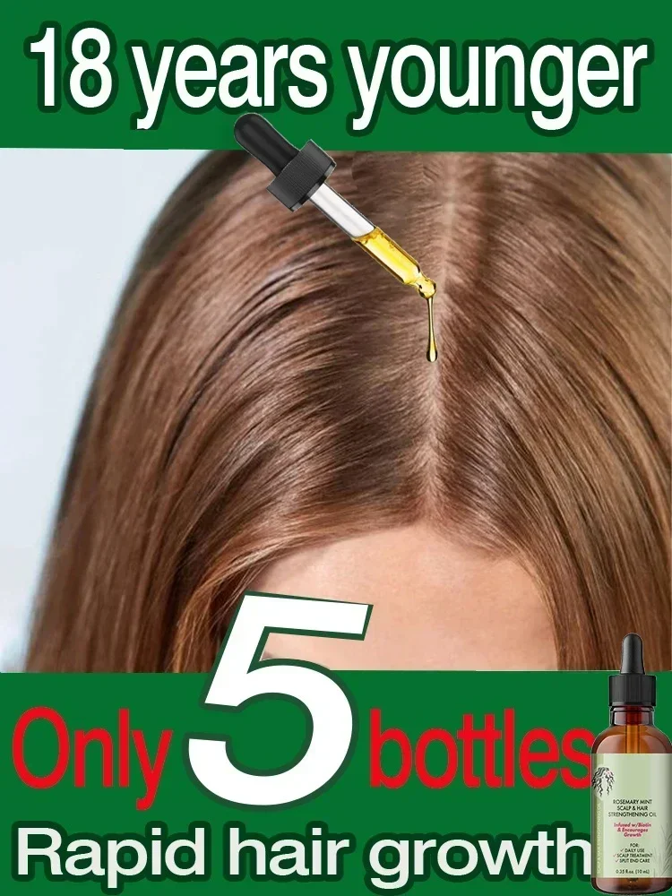 Hair Growth Essential Oil Pure Natural Rosemary Mint Hair Strengthening Oil Nourishing Treatment for Split Ends Dry Mielle
Hair Growth Essential Oil Pure Natural Rosemary Mint Hair Strengthening Oil Nourishing Treatment for Split Ends Dry Mielle