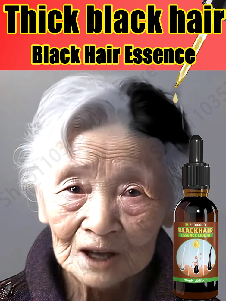 Middle-aged and elderly black hair essence takes effect in 7 days, safe and healthy
Middle-aged and elderly black hair essence takes effect in 7 days, safe and healthy