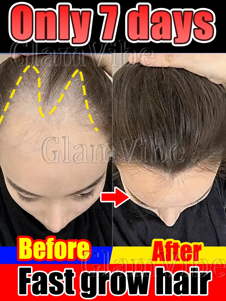 1̶0̶0̶%̶ e̶f̶f̶e̶c̶t̶i̶v̶e̶l̶y̶ absorbed, leaving pores revitalized.
1̶0̶0̶%̶ e̶f̶f̶e̶c̶t̶i̶v̶e̶l̶y̶ absorbed, leaving pores revitalized.