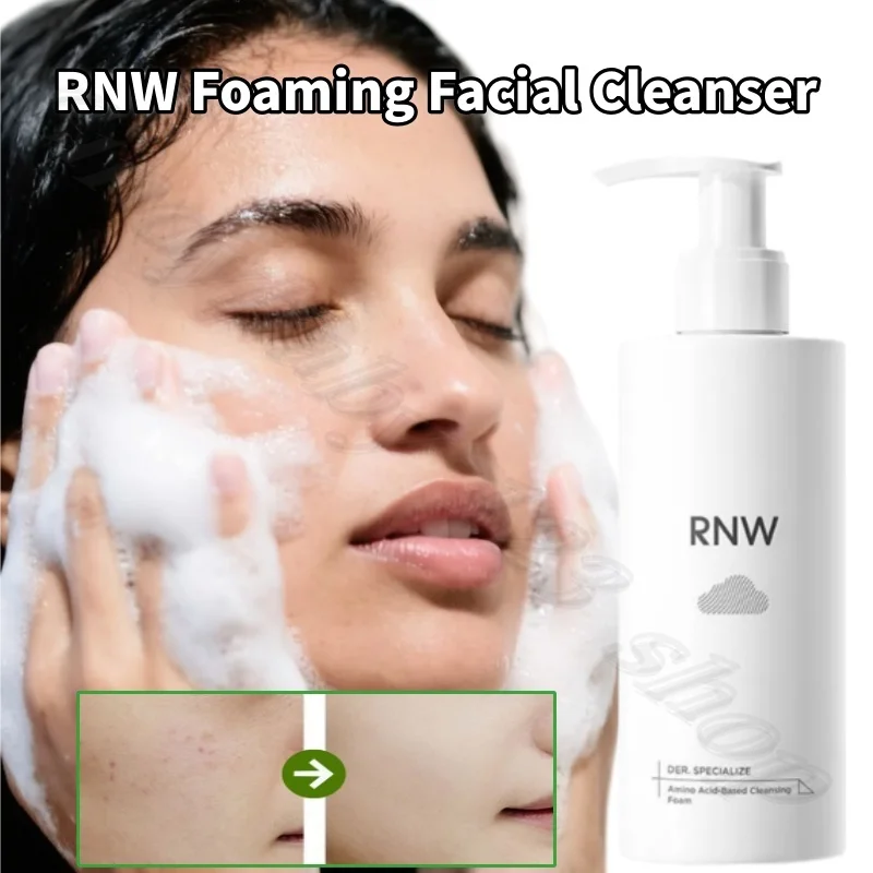 RNW foaming facial cleanser refreshing oil control moisturizing deep cleansing acne India sensitive muscle application 200g
RNW foaming facial cleanser refreshing oil control moisturizing deep cleansing acne India sensitive muscle application 200g