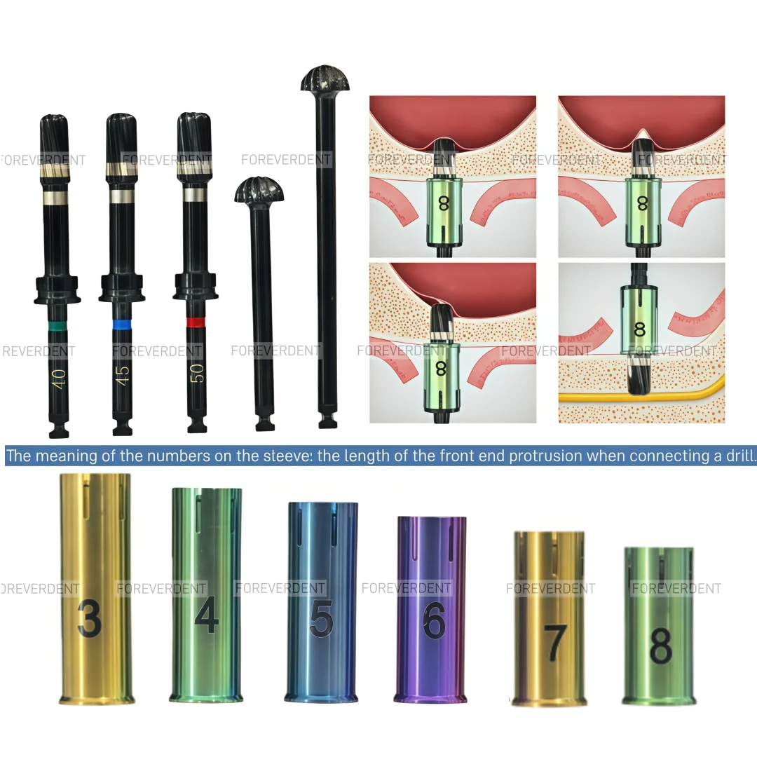 Стоматологические сверла для синус-лифтинга, расширители, ограничители, имплантационные крестальные сверла, втулки для сверл с DLC-покрытием
Стоматологические сверла для синус-лифтинга, расширители, ограничители, имплантационные крестальные сверла, втулки для сверл с DLC-покрытием