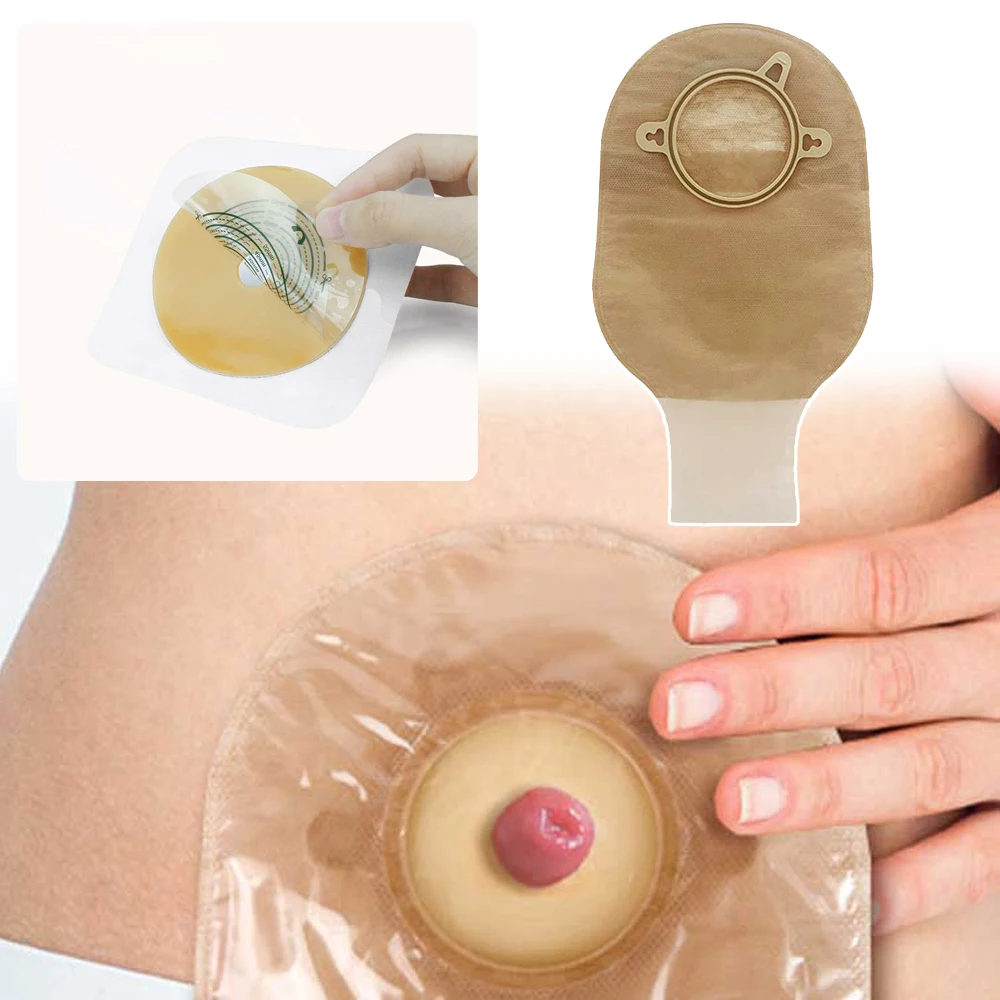 10Pcs Ostomy Supplies Open Clip Ostomy Bags Colostomy Bags Two Piece Drainable Pouches with Hoop and Look Ileostomy Stoma Care
10Pcs Ostomy Supplies Open Clip Ostomy Bags Colostomy Bags Two Piece Drainable Pouches with Hoop and Look Ileostomy Stoma Care