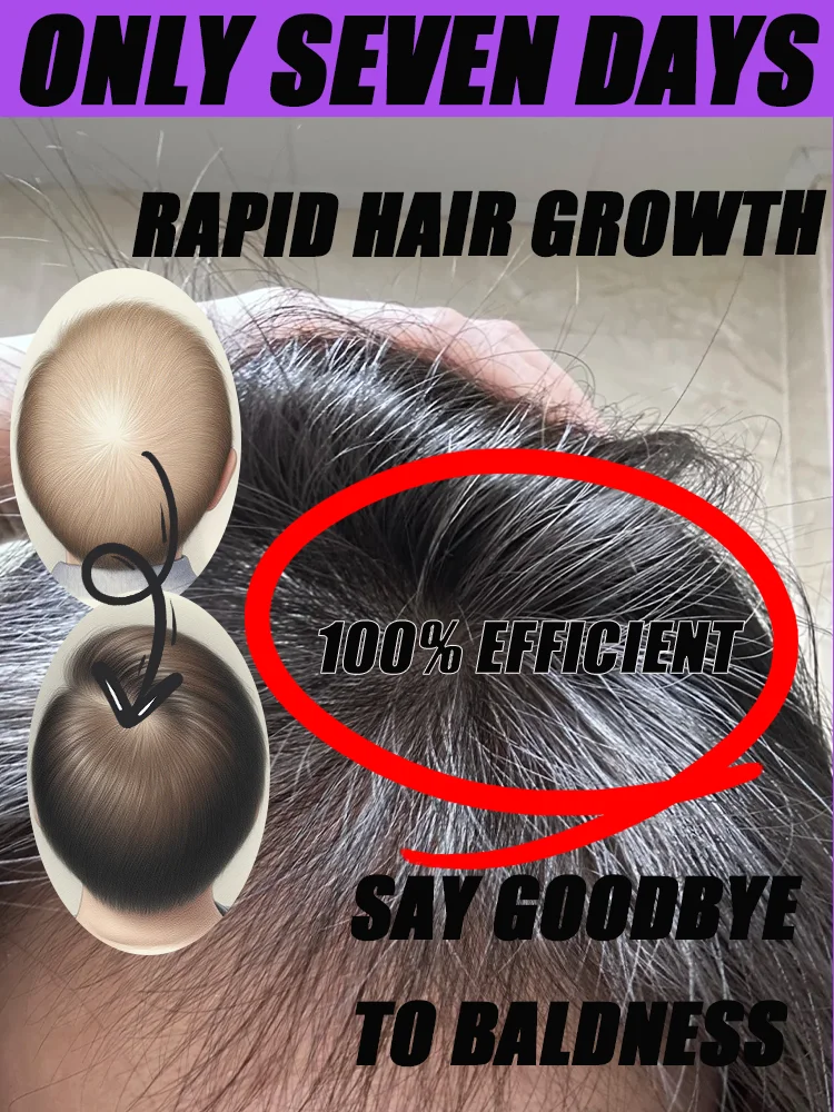 Lᴏsɪɴɢ ʜᴀɪʀ Tʜɪs ʜᴀɪʀ-ʀᴇɢᴇɴᴇʀᴀᴛɪɴɢ sᴘʀᴀʏ ᴄᴀɴ ʜᴇʟᴘ ʏᴏᴜ ɢʀᴏᴡ ᴛʜɪᴄᴋᴇʀ ʜᴀɪʀ
Lᴏsɪɴɢ ʜᴀɪʀ Tʜɪs ʜᴀɪʀ-ʀᴇɢᴇɴᴇʀᴀᴛɪɴɢ sᴘʀᴀʏ ᴄᴀɴ ʜᴇʟᴘ ʏᴏᴜ ɢʀᴏᴡ ᴛʜɪᴄᴋᴇʀ ʜᴀɪʀ