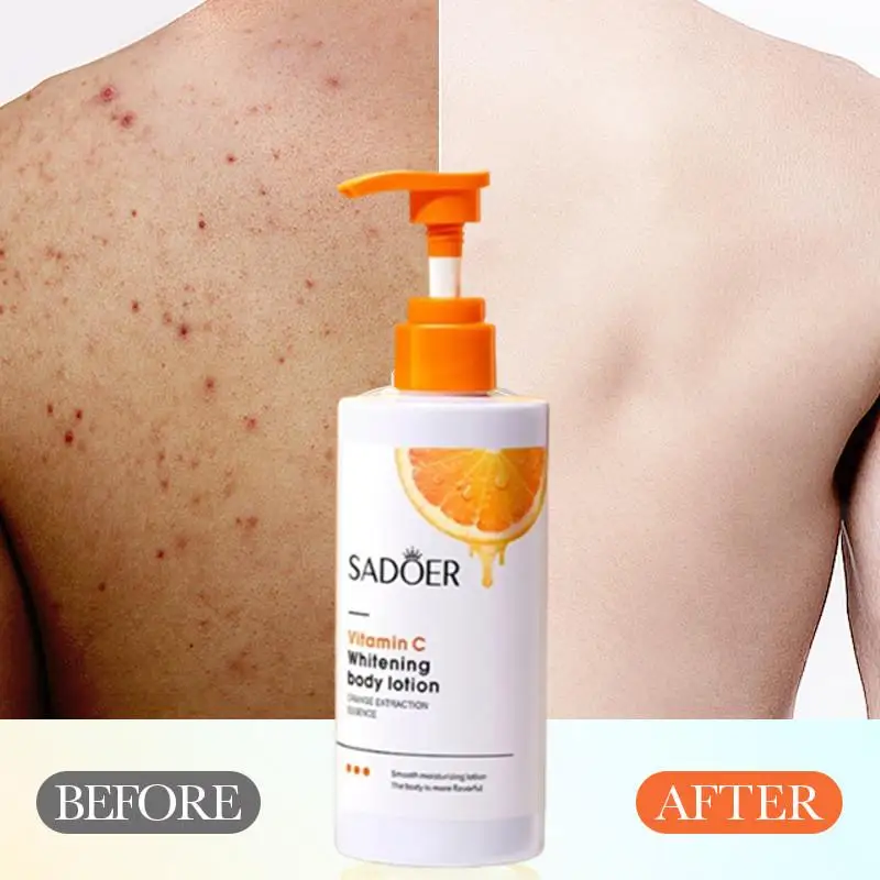 250g Vitamin C Whitening Cleansing Body Wash Whitening Shower Oils Beauty Health Body Cleansers
250g Vitamin C Whitening Cleansing Body Wash Whitening Shower Oils Beauty Health Body Cleansers