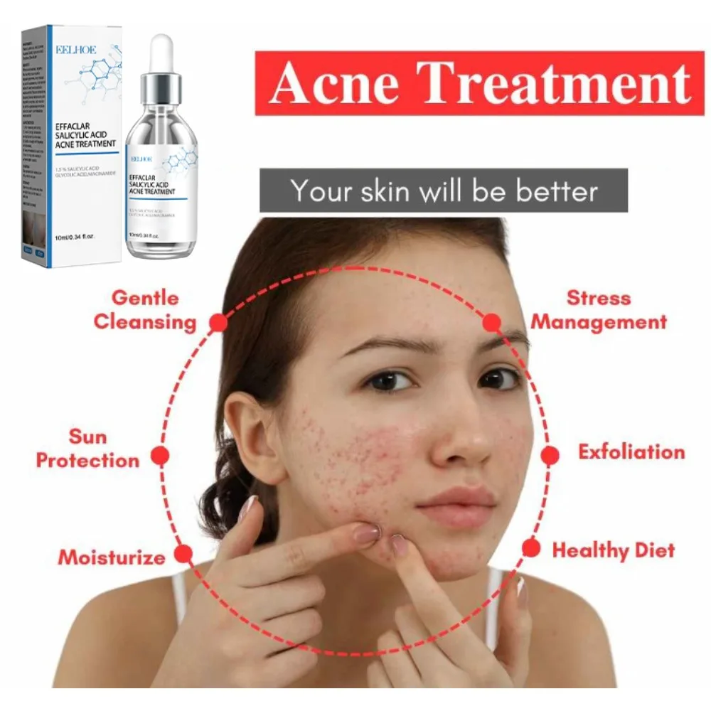 Salicylic Acid Solution Essence Shrink pores and Acne Spot Removing Shrink Pores Oil-Control Brighten Face Skin Makeup
Salicylic Acid Solution Essence Shrink pores and Acne Spot Removing Shrink Pores Oil-Control Brighten Face Skin Makeup