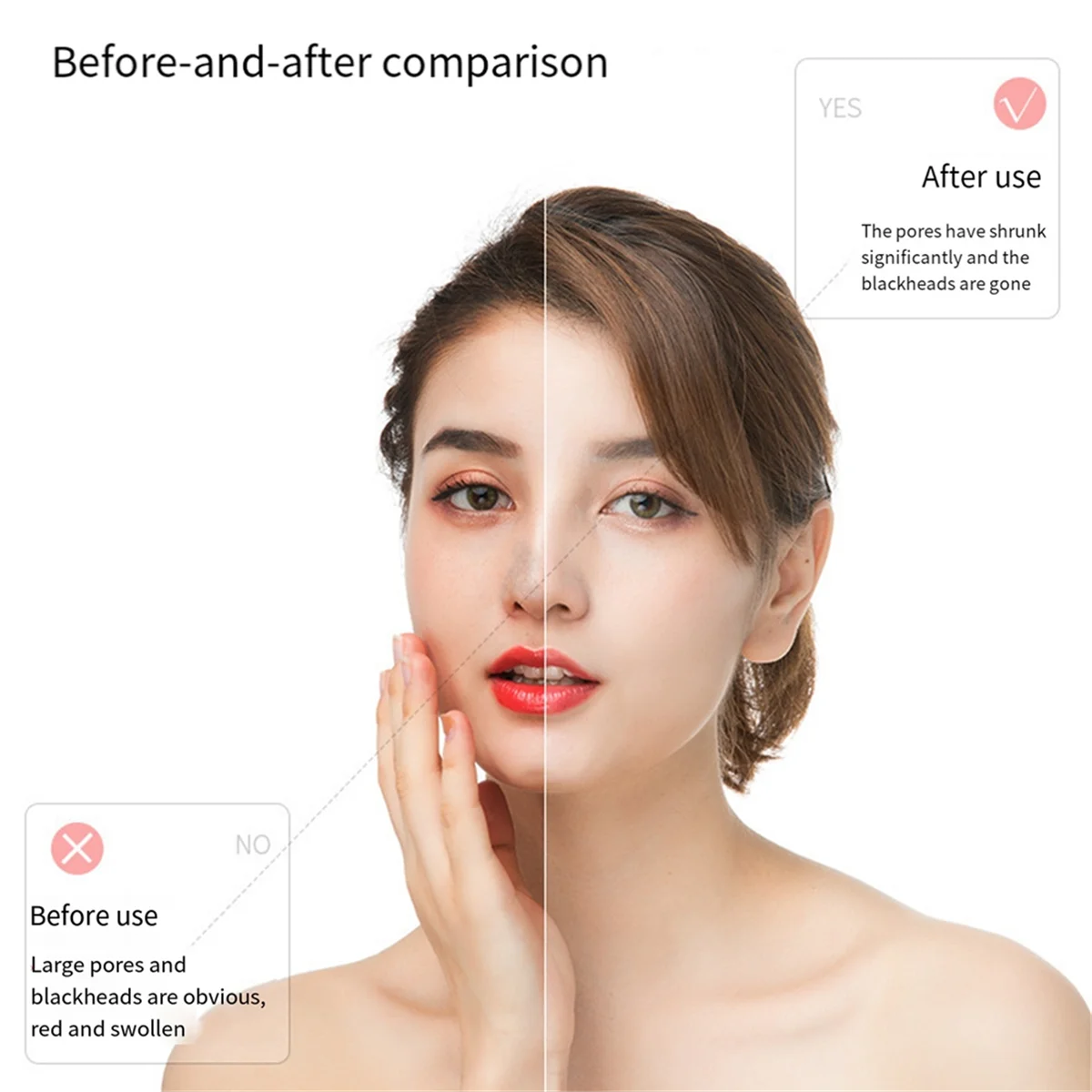 Electric Blackhead Remover Face Pimple Extraction Deep Spots Pore Acne Removal Cleaner Cleanser-A70Z
Electric Blackhead Remover Face Pimple Extraction Deep Spots Pore Acne Removal Cleaner Cleanser-A70Z