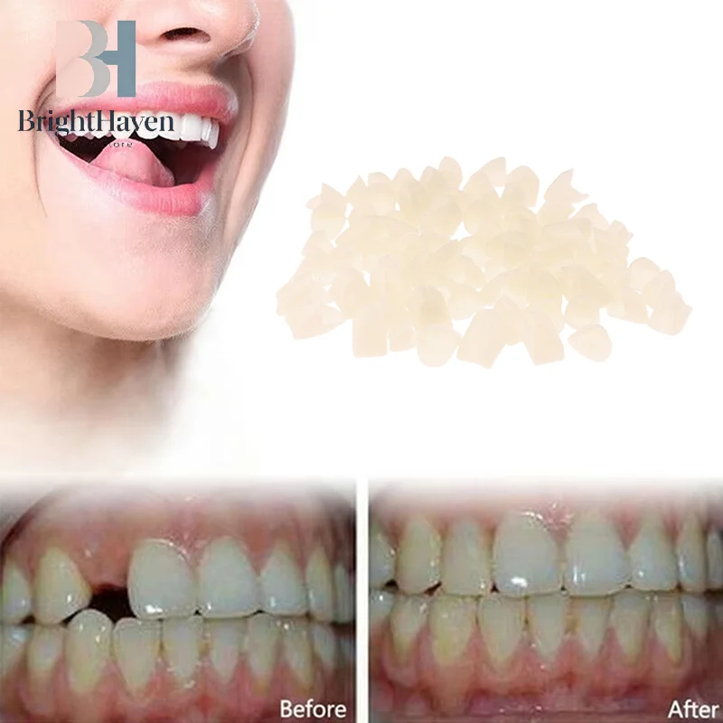 1 Bag Dental Temporary Crown Material For Anterior/Molar Teeth Veneers Gum Protection And Stable B.H
1 Bag Dental Temporary Crown Material For Anterior/Molar Teeth Veneers Gum Protection And Stable B.H