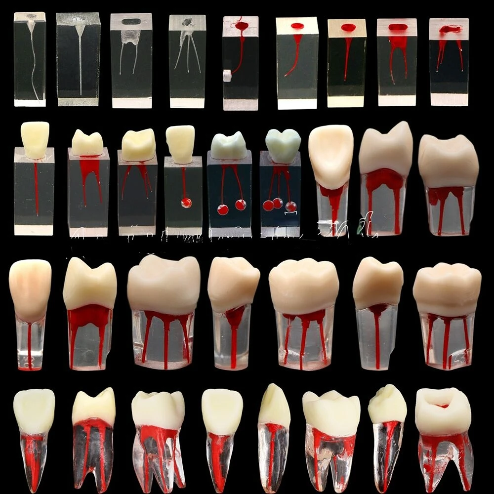 10Pcs Dental Root Canal Teeth Study Model Endodontic Rotary Files Practice Block
10Pcs Dental Root Canal Teeth Study Model Endodontic Rotary Files Practice Block