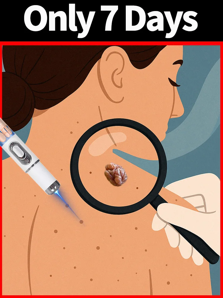 Quickly remove warts painless hot sale laser tools 
Quickly remove warts painless hot sale laser tools