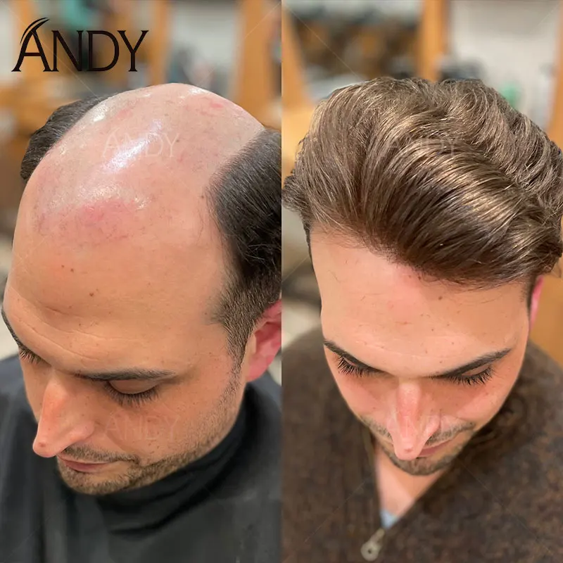 0.10-0.12mm PU Men Toupee Full Thin Skin Indian Human Hair Men's Hair Prosthesis 130% Density Natural Looking Men Wig
0.10-0.12mm PU Men Toupee Full Thin Skin Indian Human Hair Men's Hair Prosthesis 130% Density Natural Looking Men Wig