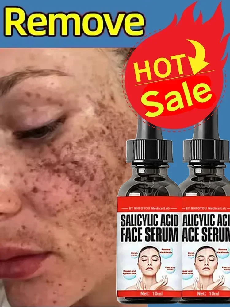 38Skincare Melasma dark spot fading cream
38Skincare Melasma dark spot fading cream