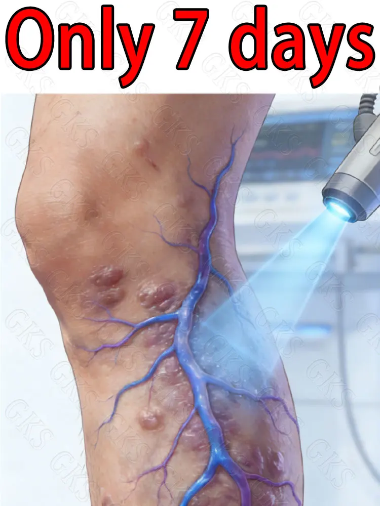 Laser vein therapy device, leg vascular closure device, relieves pain and swelling, improves circulation.
Laser vein therapy device, leg vascular closure device, relieves pain and swelling, improves circulation.
