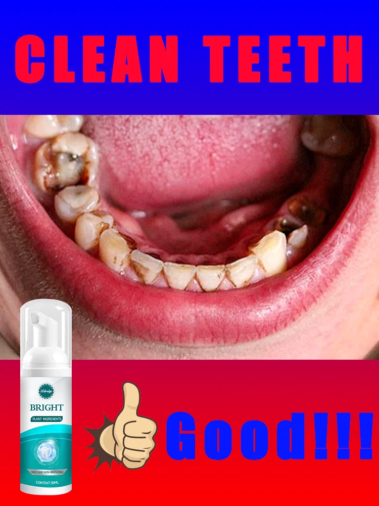 2025 Hot Oral Foam Teeth Cleaning Care Tools for Beauty-Efficient Dental Hygiene Products
2025 Hot Oral Foam Teeth Cleaning Care Tools for Beauty-Efficient Dental Hygiene Products