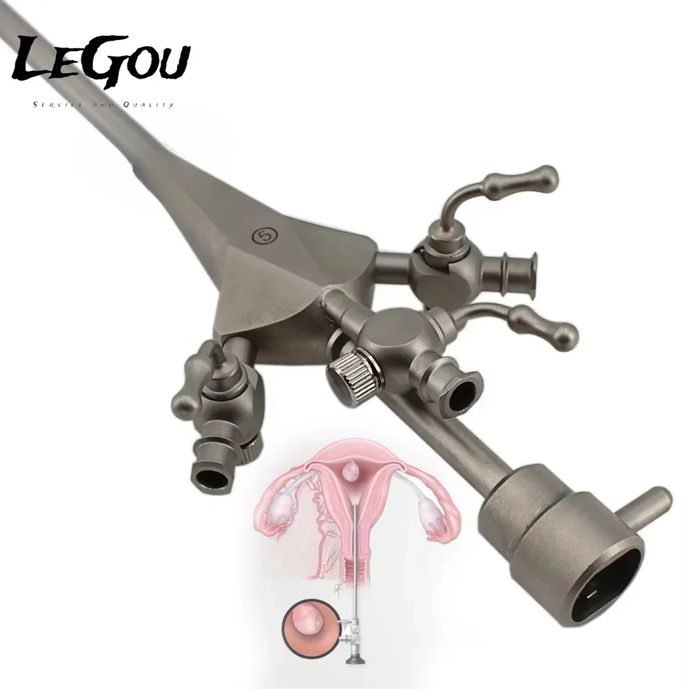 LeGou Professional 2.9mm 30 Degree 16.5 Fr Hysteroscope Hysteroscopy Set for Gynecology Manual Power Source Surgical Medical En
LeGou Professional 2.9mm 30 Degree 16.5 Fr Hysteroscope Hysteroscopy Set for Gynecology Manual Power Source Surgical Medical En