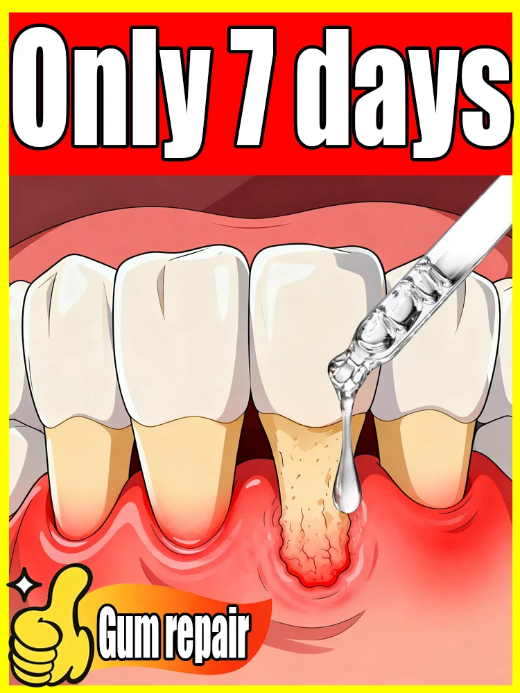 Eᴀsɪʟʏ ʀᴇɢᴀɪɴ ʜᴇᴀʟᴛʜʏ ɢᴜᴍs ᴀɴᴅ ᴇɴᴄᴀsᴇ ᴛᴇᴇᴛʜ ᴡɪᴛʜɪɴ ᴀ ᴡᴇᴇᴋ
Eᴀsɪʟʏ ʀᴇɢᴀɪɴ ʜᴇᴀʟᴛʜʏ ɢᴜᴍs ᴀɴᴅ ᴇɴᴄᴀsᴇ ᴛᴇᴇᴛʜ ᴡɪᴛʜɪɴ ᴀ ᴡᴇᴇᴋ