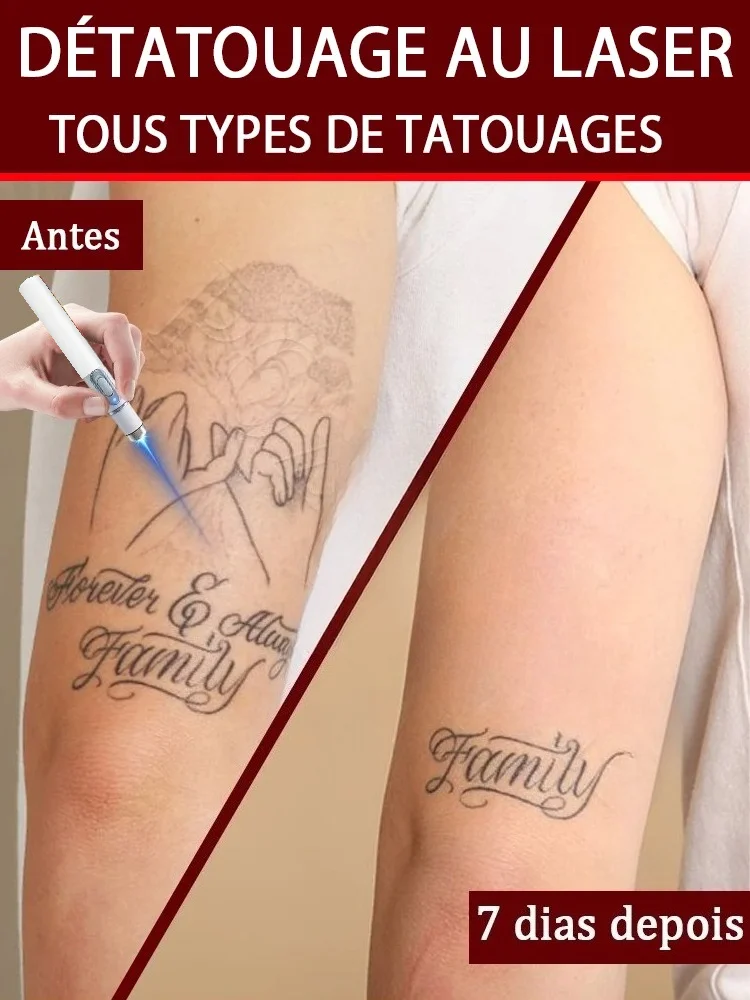 sooʇʇɐʇ puɐ ʻsooʇʇɐʇ ʍoɹqǝʎǝ ʻsooʇʇɐʇ dᴉʅ ʻsooʇʇɐʇ ⅎo ʅɐʌoɯǝɹ ɹǝsɐ⅂
sooʇʇɐʇ puɐ ʻsooʇʇɐʇ ʍoɹqǝʎǝ ʻsooʇʇɐʇ dᴉʅ ʻsooʇʇɐʇ ⅎo ʅɐʌoɯǝɹ ɹǝsɐ⅂