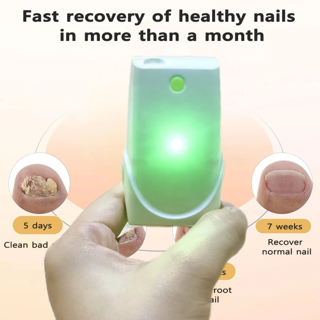 HLKGO Rechargeable Nail Renewal Laser - Dual 470nm+905nm Infrared Light - Supports Healthy Looking Nails & Foot Care
HLKGO Rechargeable Nail Renewal Laser - Dual 470nm+905nm Infrared Light - Supports Healthy Looking Nails & Foot Care