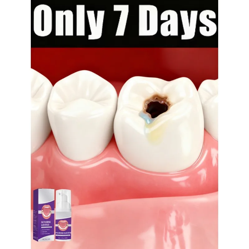 Модернизированный зуб 3-го поколения восстановление корня зуба рвлют очищает бактерии полости рта.
Модернизированный зуб 3-го поколения восстановление корня зуба рвлют очищает бактерии полости рта.