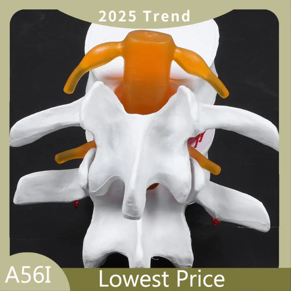 ABDD 1 Pcs Skeleton Spine Lumbar Disc Herniation Teaching Model & 1 Pcs Human Anatomy Skeleton Spine Vertebral Model
ABDD 1 Pcs Skeleton Spine Lumbar Disc Herniation Teaching Model & 1 Pcs Human Anatomy Skeleton Spine Vertebral Model