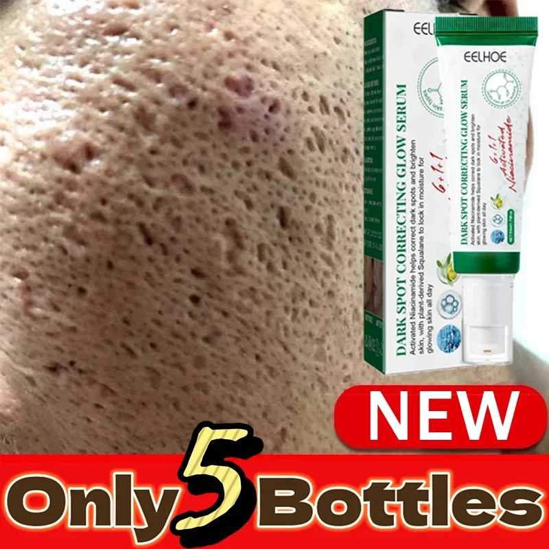 Acne pit pit repair men and women to acne print pit acne scar cream anti-inflammatory non-repair fade
Acne pit pit repair men and women to acne print pit acne scar cream anti-inflammatory non-repair fade