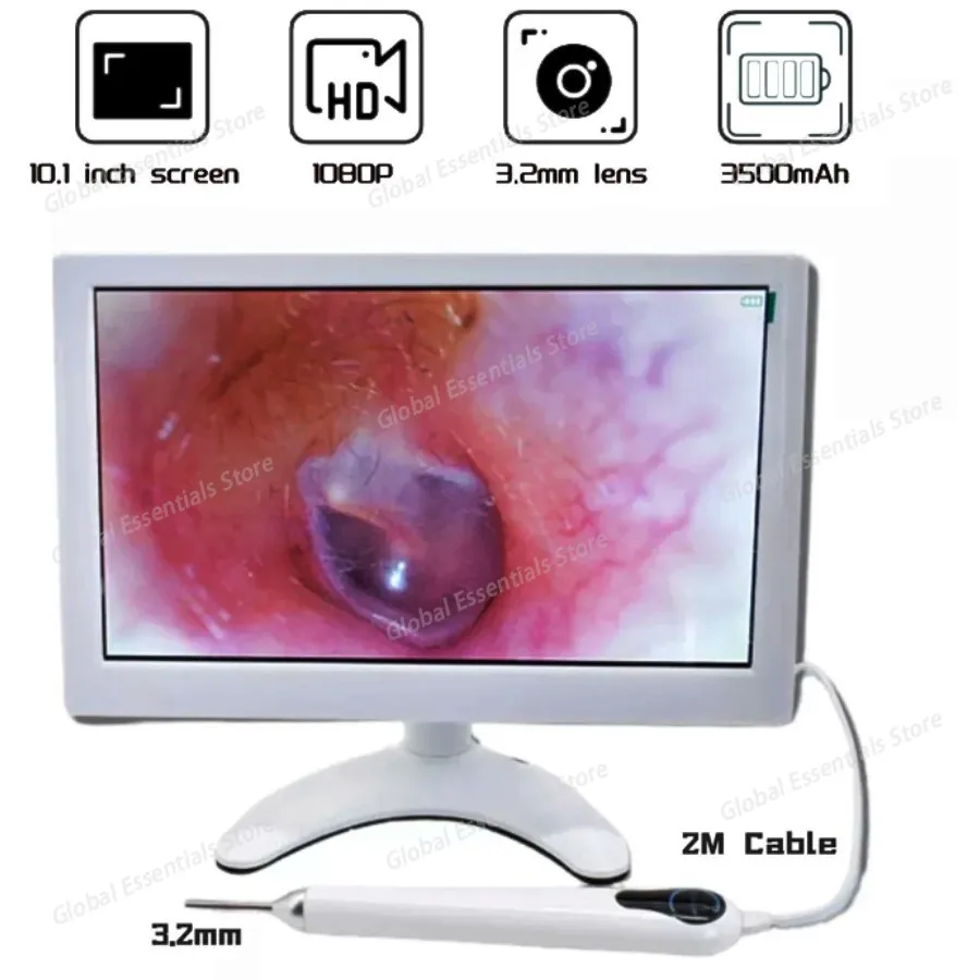 Otoscope with 3.2MM Lens, 10-inch Display Screen and Built-in Stand – Wired Visual Ear Cleaning Tool for Training
Otoscope with 3.2MM Lens, 10-inch Display Screen and Built-in Stand – Wired Visual Ear Cleaning Tool for Training
