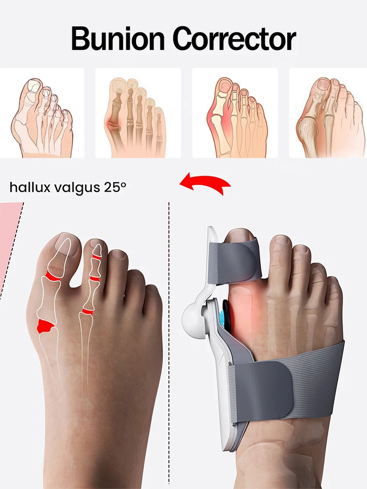 Bunion Corrector Orthopedic Toe Straightener Feet Pedicure Protection Hallux Valgus Bunion Splint Corrector Tools
Bunion Corrector Orthopedic Toe Straightener Feet Pedicure Protection Hallux Valgus Bunion Splint Corrector Tools