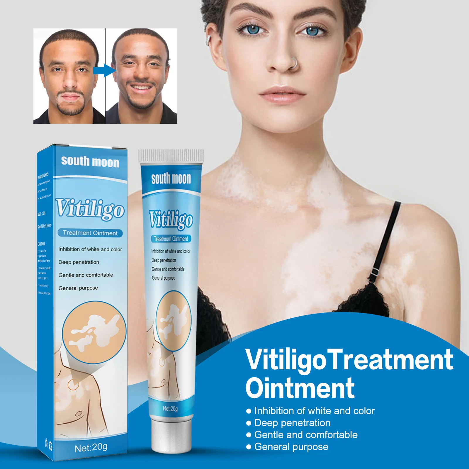 Vitiligo Removal Cream Fast Acting Leukoplakia Vitiligo Repair Cream Natural White Spot Soothing Cream Ointment Health Care 20g
Vitiligo Removal Cream Fast Acting Leukoplakia Vitiligo Repair Cream Natural White Spot Soothing Cream Ointment Health Care 20g