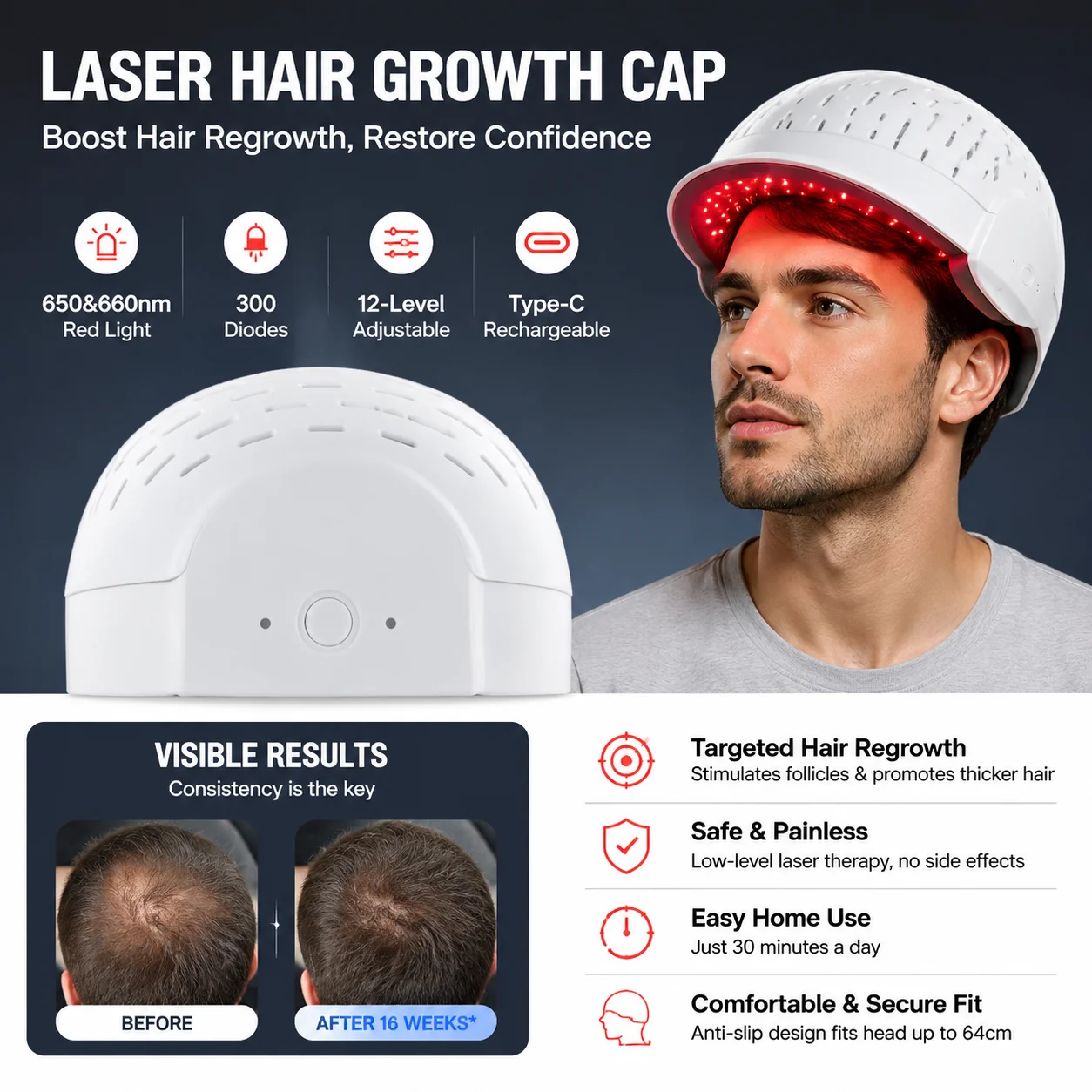 Hair Regrowth Helmet 650nm 660nm Dual Wavelength 12 Level Power 1-20000Hz Frequency Type-C for Thinning Hair Baldness Treatment
Hair Regrowth Helmet 650nm 660nm Dual Wavelength 12 Level Power 1-20000Hz Frequency Type-C for Thinning Hair Baldness Treatment
