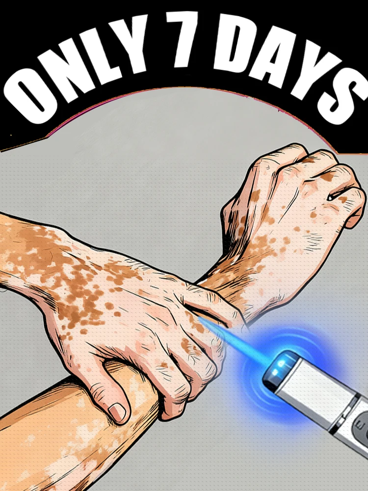 2025Generation-2, ручка синего света Solve Vitiligo Tool
2025Generation-2, ручка синего света Solve Vitiligo Tool