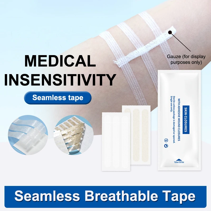 1 Bag Wound Skin Closure Strips Postpartum Wound Repair Cosmetic Surgery Strip Adhesive Medical Suture Free Surgical Tape
1 Bag Wound Skin Closure Strips Postpartum Wound Repair Cosmetic Surgery Strip Adhesive Medical Suture Free Surgical Tape