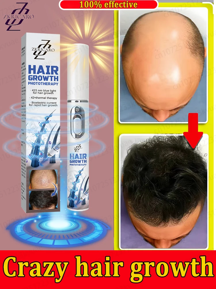 Activate hair follicles, say goodbye to baldness, the most effective hair growth product in 2025
Activate hair follicles, say goodbye to baldness, the most effective hair growth product in 2025
