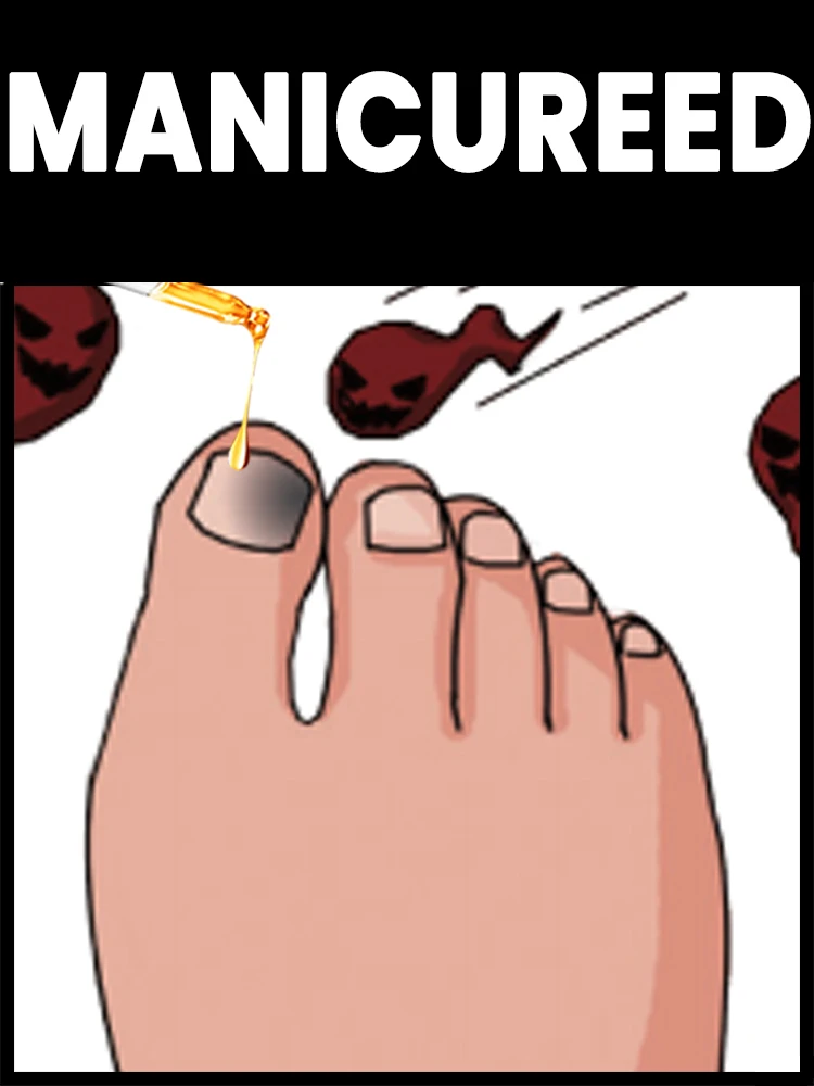 Fungal Nail Solution Serum, Daily Care for Damaged Nails, Fast Absorption with Clove and Thyme Oils, 5 Pack
Fungal Nail Solution Serum, Daily Care for Damaged Nails, Fast Absorption with Clove and Thyme Oils, 5 Pack