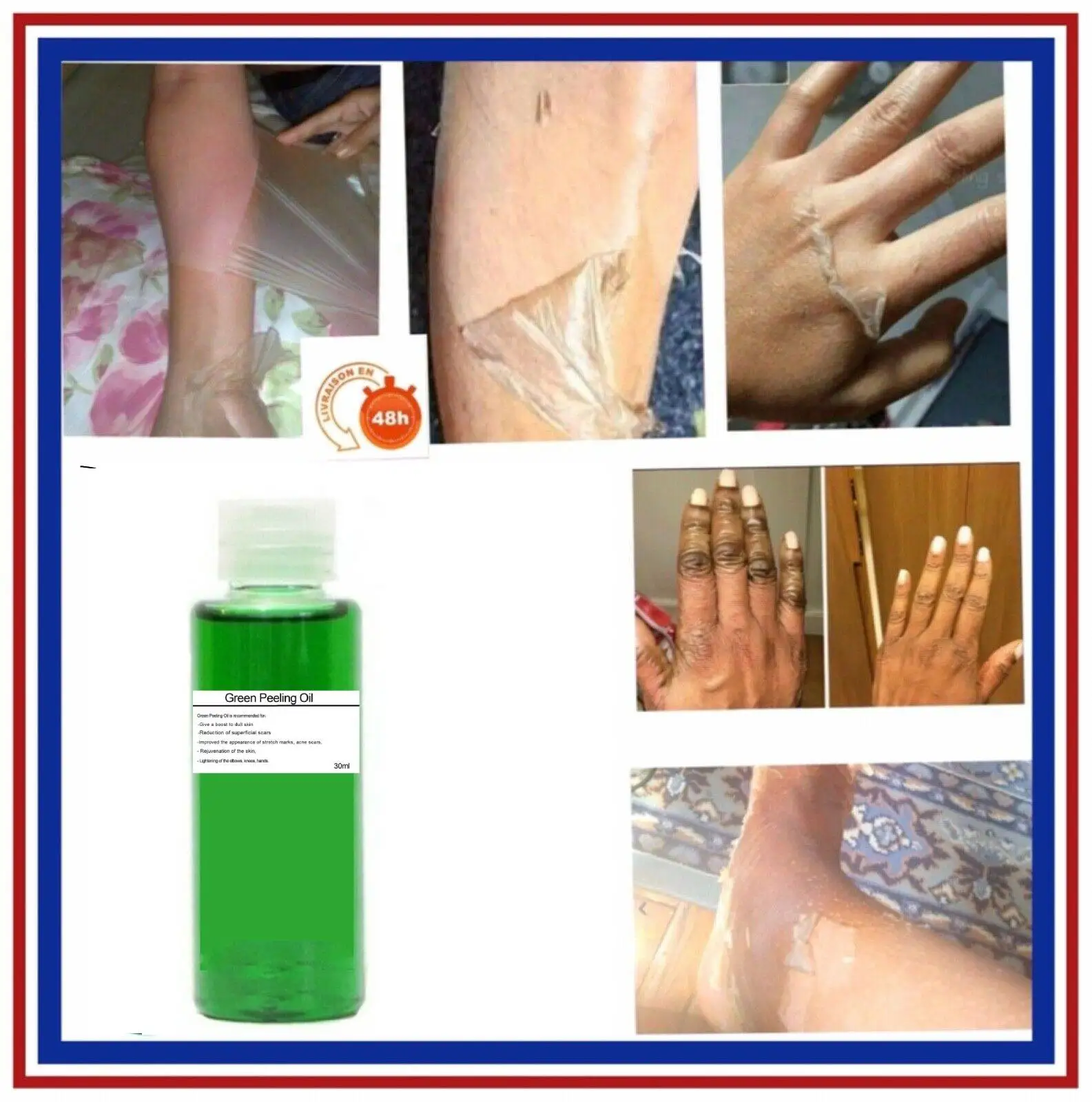 Green peeling oil - Anti-Wrinkle Face Serum Whitening Moisturizing Anti-Acne Essence Brighten Firming Skin Care
Green peeling oil - Anti-Wrinkle Face Serum Whitening Moisturizing Anti-Acne Essence Brighten Firming Skin Care