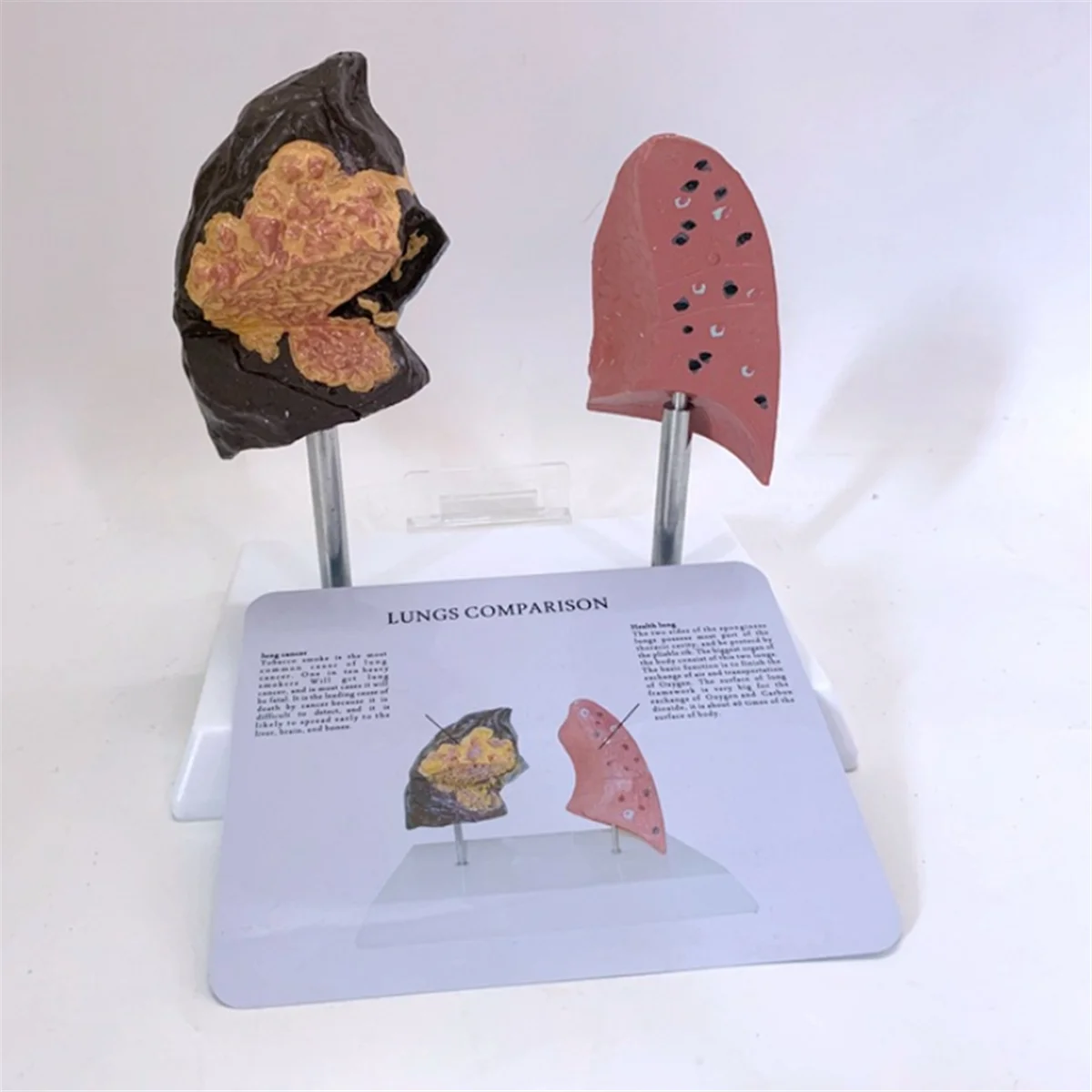 Модель легких Smoker'S, модель для здоровья легких, модель анатомии легких с патологической дыхательной системой, болезни легких
Модель легких Smoker'S, модель для здоровья легких, модель анатомии легких с патологической дыхательной системой, болезни легких
