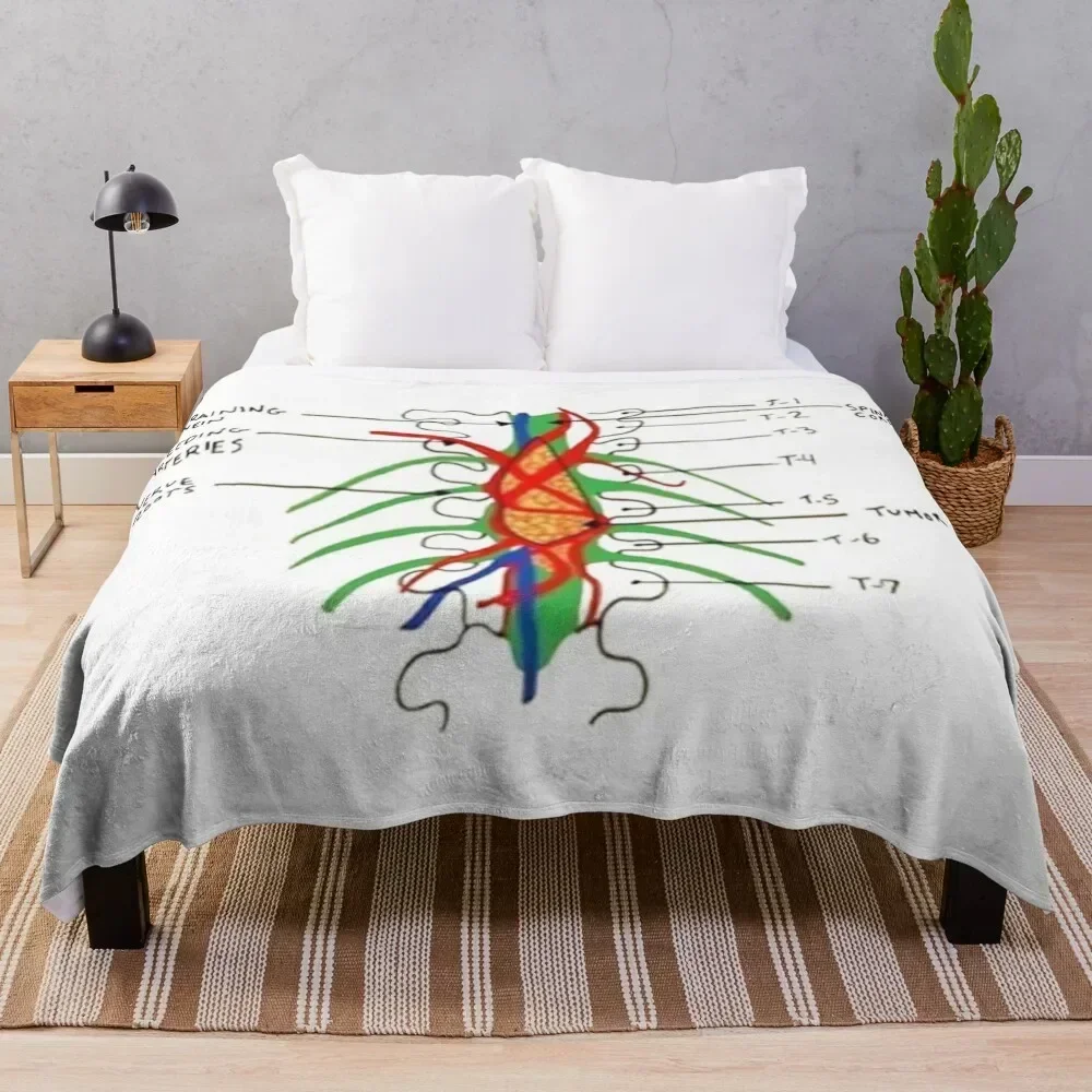 Greys - Spinal tumour Throw Blanket Soft Breathable Blanket for Night Sleeping
Greys - Spinal tumour Throw Blanket Soft Breathable Blanket for Night Sleeping