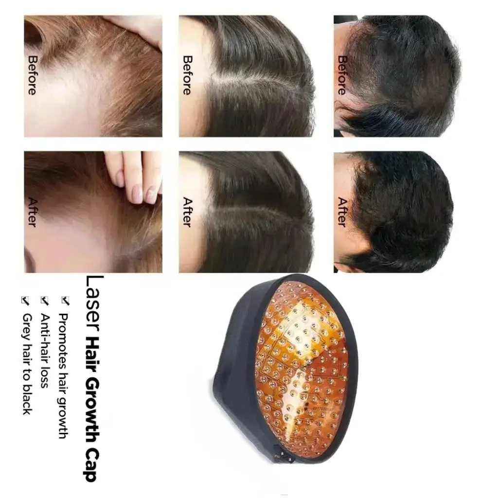 96 Diodes Stimulates Dormant Follicles Reduces Hair Shedding – Strengthens Roots To Minimize Excessive Daily Loss
96 Diodes Stimulates Dormant Follicles Reduces Hair Shedding – Strengthens Roots To Minimize Excessive Daily Loss