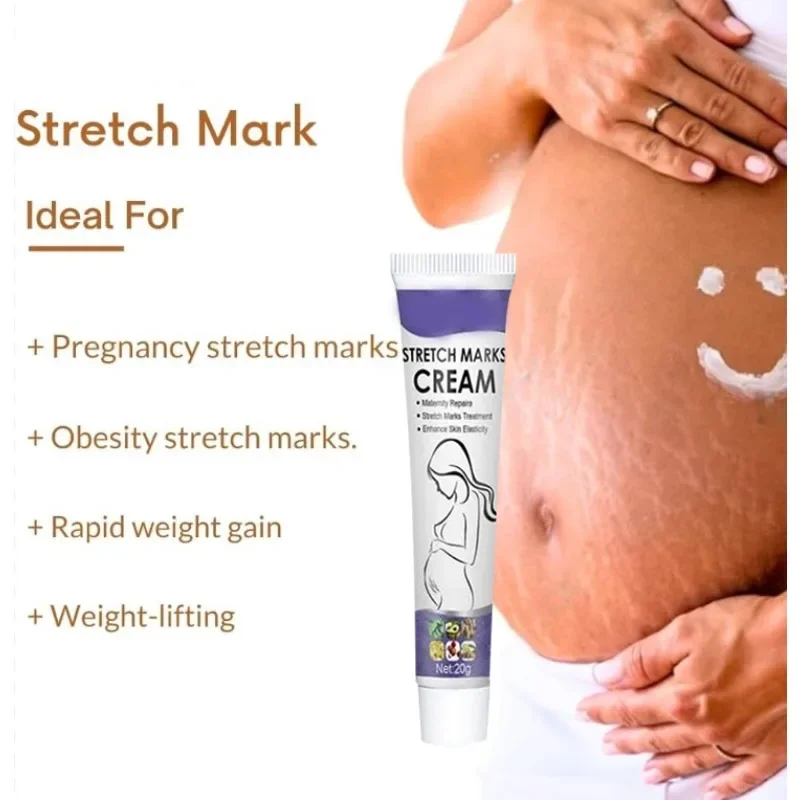 Skin Care Improves Elasticity Effective After Pregnancy Stretch Marks Removal Powerful Maternity Cream Nourishes Skin
Skin Care Improves Elasticity Effective After Pregnancy Stretch Marks Removal Powerful Maternity Cream Nourishes Skin