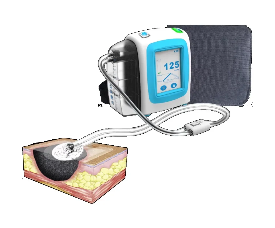 Negative Pressure Wound Therapy Machine with Drainage Canister 140ml/450ml & 10sets Different Size NPWT Medical Dressing Kit
Negative Pressure Wound Therapy Machine with Drainage Canister 140ml/450ml & 10sets Different Size NPWT Medical Dressing Kit
