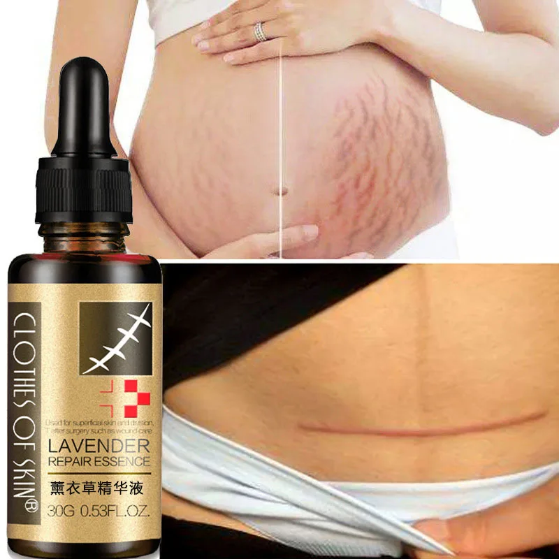 Lavender Repair Serum, Hydrating and Insulating, Repairing Skin lavender oil
Lavender Repair Serum, Hydrating and Insulating, Repairing Skin lavender oil
