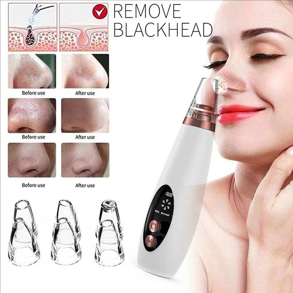 Electric Pore Blackhead Removal Vacuum Cleanser Acne Removal Blackhead Remover Facial Pore Cleaner Machine Beauty Skin Care
Electric Pore Blackhead Removal Vacuum Cleanser Acne Removal Blackhead Remover Facial Pore Cleaner Machine Beauty Skin Care