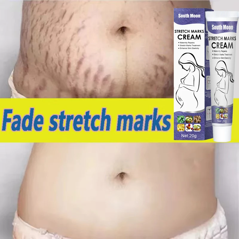 Stretch Marks Permanent Removal Cream Maternity Pregnant Women Pregnancy Anti-Winkle Smooth Repair Firming Skin Body Skin Care
Stretch Marks Permanent Removal Cream Maternity Pregnant Women Pregnancy Anti-Winkle Smooth Repair Firming Skin Body Skin Care