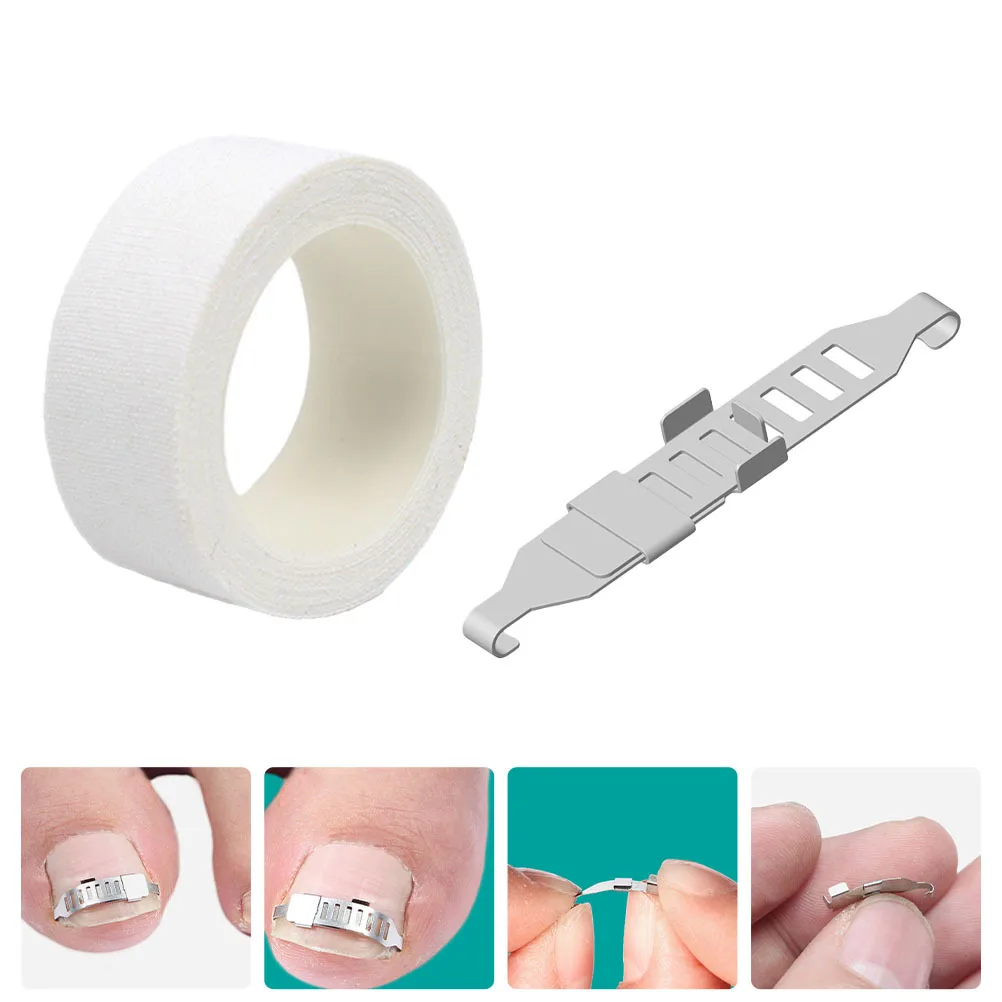 1Set Nail Inlay Corrector Ingrown Toenail Tool Safe Easy Use Toenail Correction Care Set Pedicure Tool Nail Inlay Corrector
1Set Nail Inlay Corrector Ingrown Toenail Tool Safe Easy Use Toenail Correction Care Set Pedicure Tool Nail Inlay Corrector