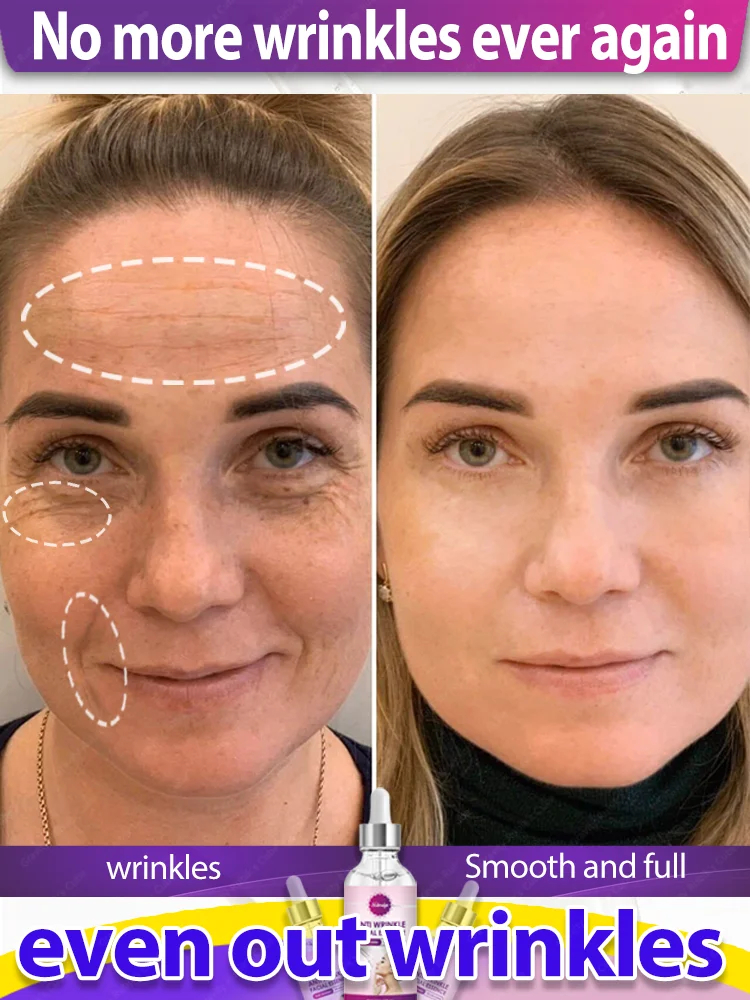 Instant Anti Wrinkle Facial Serum Anti Aging Lift Firm Fade Face & Eye Fine Line Remove Neck Wrinkle Moisturize Skin Korean Care
Instant Anti Wrinkle Facial Serum Anti Aging Lift Firm Fade Face & Eye Fine Line Remove Neck Wrinkle Moisturize Skin Korean Care