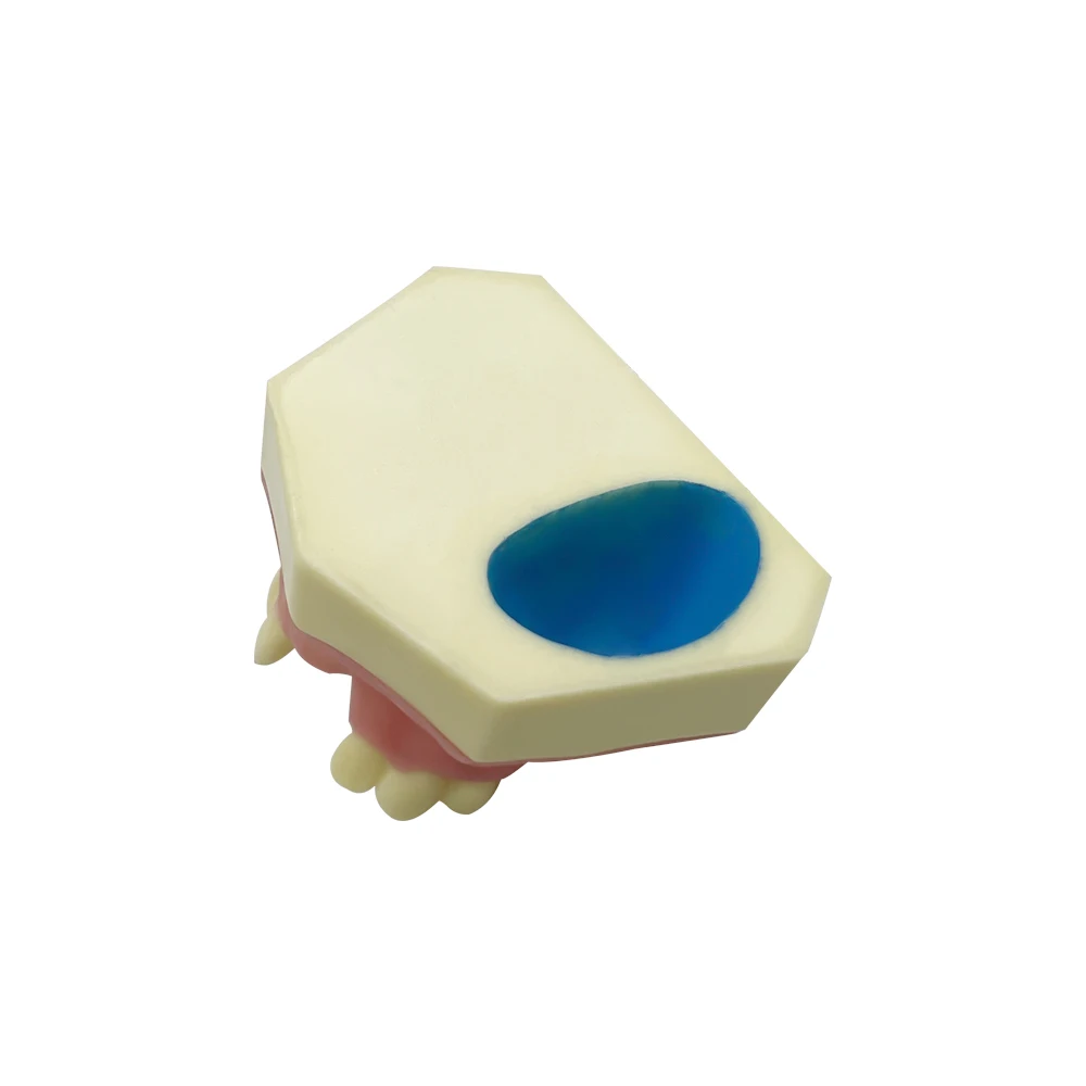 Dental Missing Tooth Dental Implant Teeth Model Student Teaching Training Aid Practice Model Dentist Studying Demonstration
Dental Missing Tooth Dental Implant Teeth Model Student Teaching Training Aid Practice Model Dentist Studying Demonstration