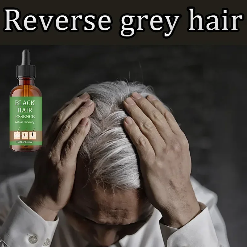 Healthy White To Black hair Anti-grey hair essence Serum treatment restore quickly turns white ahair into black naturalcolor
Healthy White To Black hair Anti-grey hair essence Serum treatment restore quickly turns white ahair into black naturalcolor