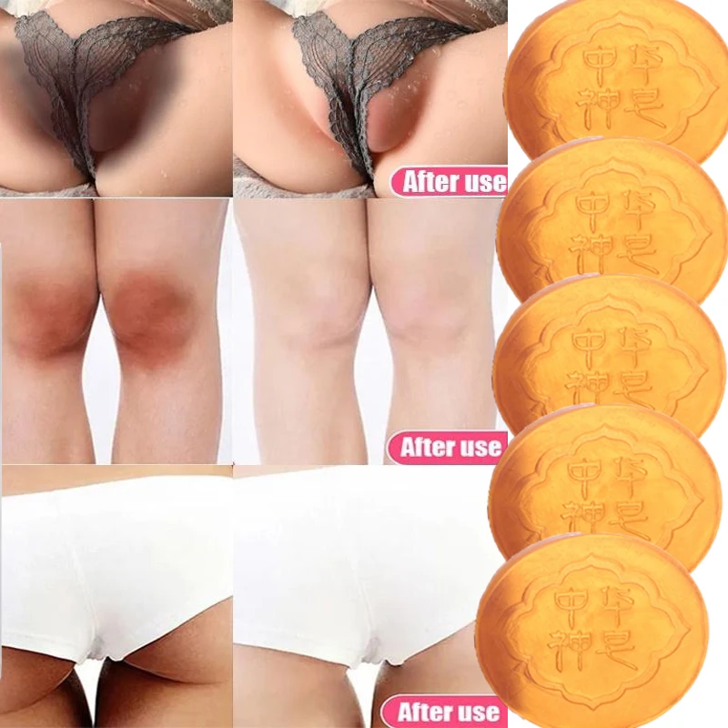 Дезодорирующее мыло для тела ручной работы с койевой кислотой для отшелушивания, увлажнения, глубокого очищения, удаления пятен, отбеливающее мыло для удаления прыщей
Дезодорирующее мыло для тела ручной работы с койевой кислотой для отшелушивания, увлажнения, глубокого очищения, удаления пятен, отбеливающее мыло для удаления прыщей