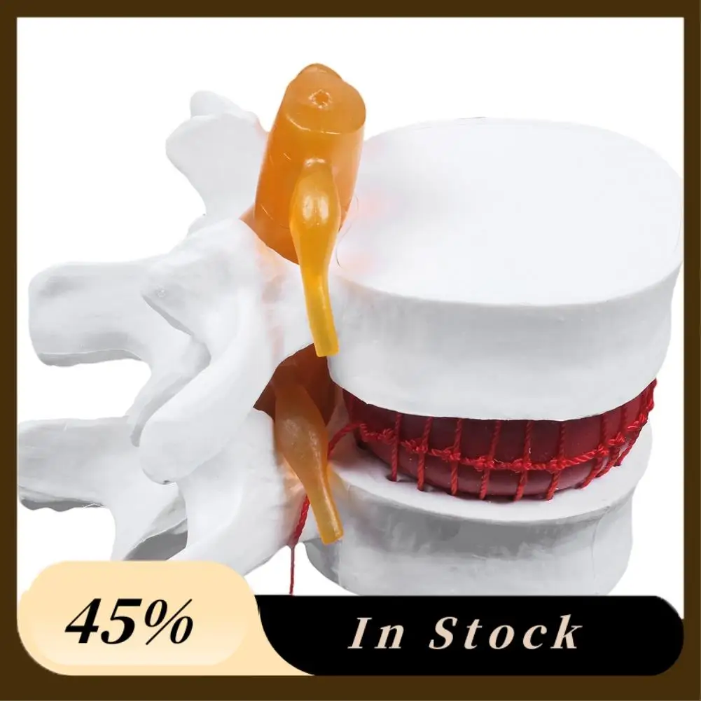 2025 Trend1 Pcs Skeleton Spine Lumbar Disc Herniation Teaching Model & 1 Pcs Human Anatomy Skeleton Spine Vertebral Model
2025 Trend1 Pcs Skeleton Spine Lumbar Disc Herniation Teaching Model & 1 Pcs Human Anatomy Skeleton Spine Vertebral Model