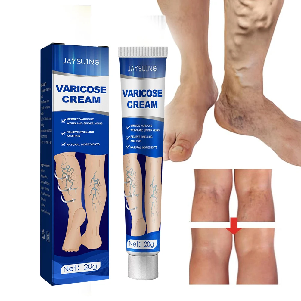 Vein repair cream reduces varicose veins, promotes blood circulation and vasoconstriction essence of leg care
Vein repair cream reduces varicose veins, promotes blood circulation and vasoconstriction essence of leg care