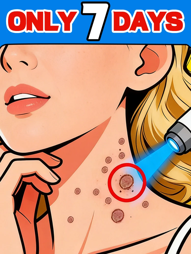 Painless and scar-free, medically certified,Nursing tools for ʷᵃʳᵗ ʳᵉᵐᵒᵛᵃˡ
Painless and scar-free, medically certified,Nursing tools for ʷᵃʳᵗ ʳᵉᵐᵒᵛᵃˡ