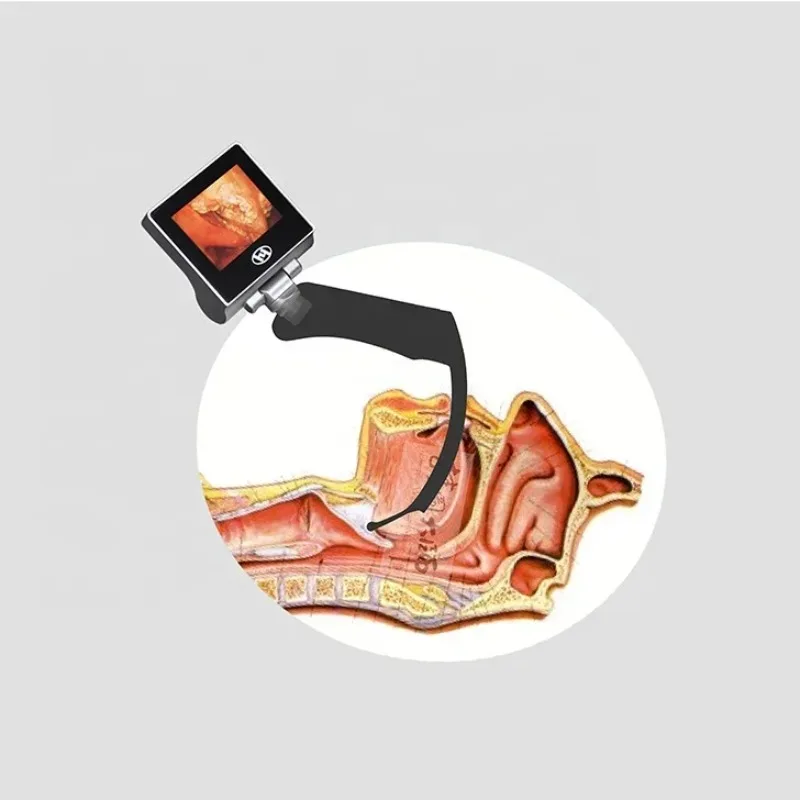 2025/Electronical Endoscope Reasonable price Difficult Airway Intubation 5 blades video laryngoscope
2025/Electronical Endoscope Reasonable price Difficult Airway Intubation 5 blades video laryngoscope